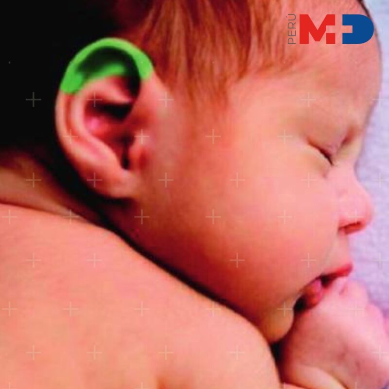 Bilirrubinómetro NO INVASIVO Bilicare - Imagen 2