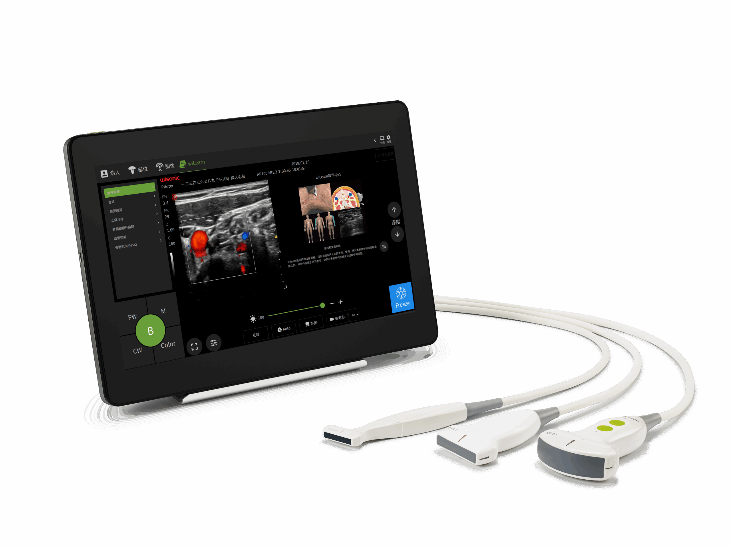 Wilearn With 3 Probe Scaled