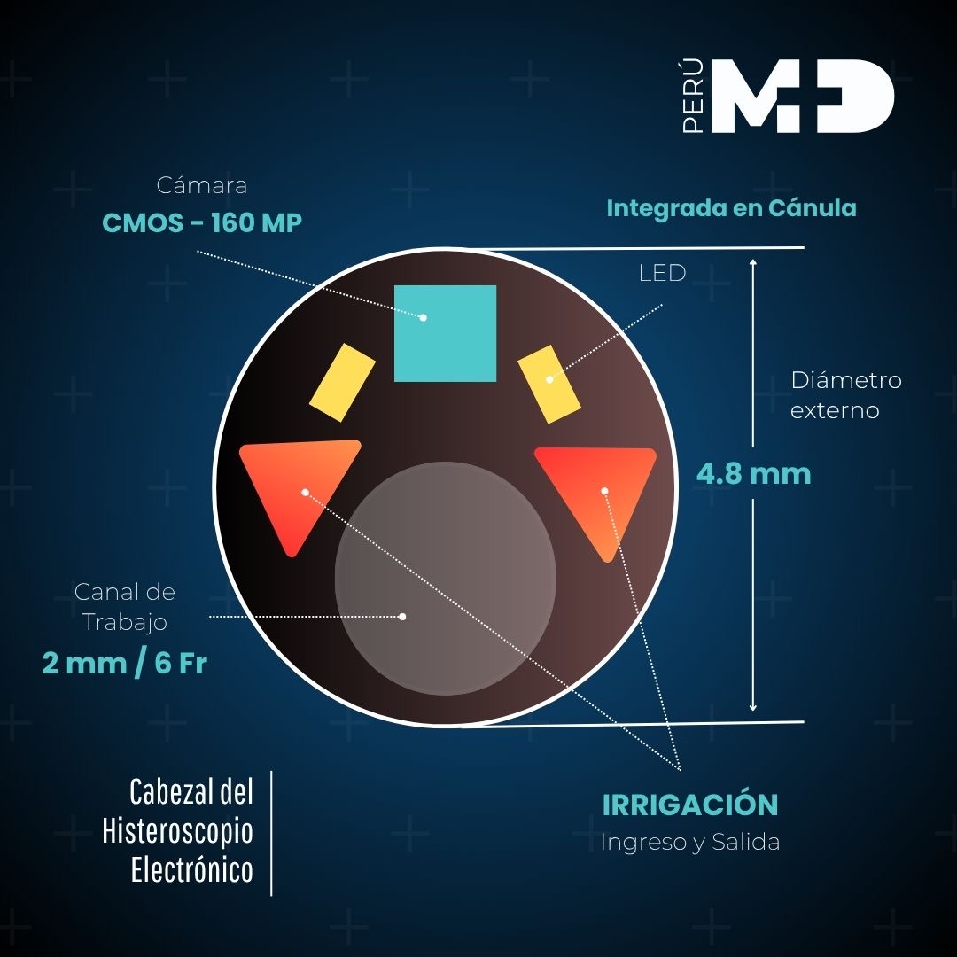 Histeroscopio descartable ARMI, kit de inicio Punta del histeroscopio ARMI: cámara, LED, canal de trabajo de 2 mm e irrigación