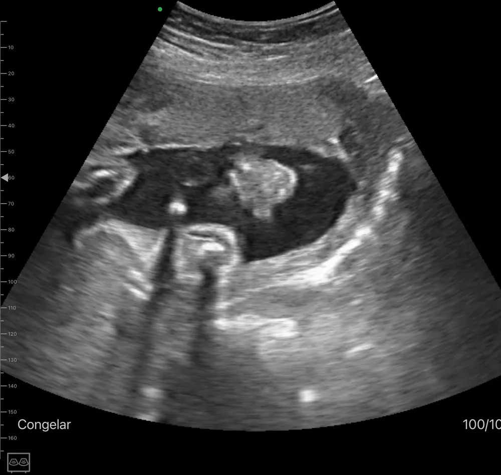 Ecógrafo ginecológico de mano KONTED C10QT, 2 en 1 Imagen ecográfica fetal con el ecógrafo KONTED C10QT