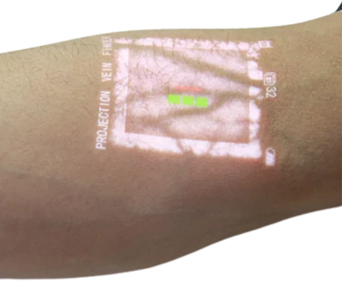 Proyección de venas en el antebrazo con detección de profundidad del VIVOLIGHT V800P