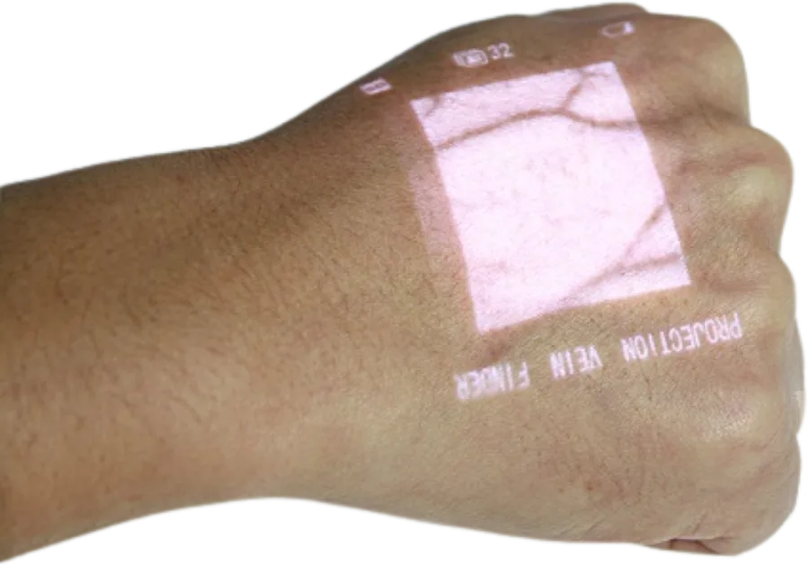 Proyección del mapa de venas en el dorso de la mano con el visualizador VIVOLIGHT V800P